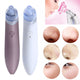 USB Powered Blackhead Remover-TopOnlineBargains.Com