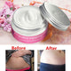 Stretch Mark Remover Pregnancy Repairing Cream-TopOnlineBargains.Com
